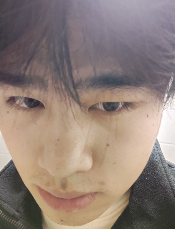 伤男的第一张照片--政和交友网